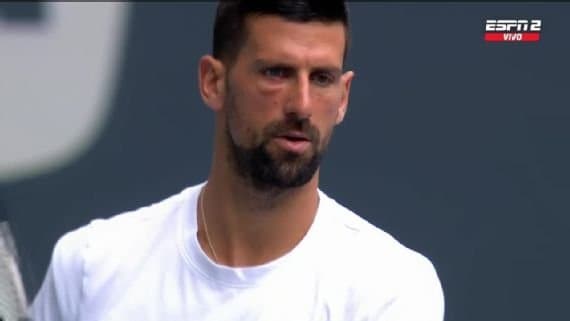 Incertidumbre Rodea a Djokovic Tras Aparición con Ojo Hinchado Antes de la Final en Miami